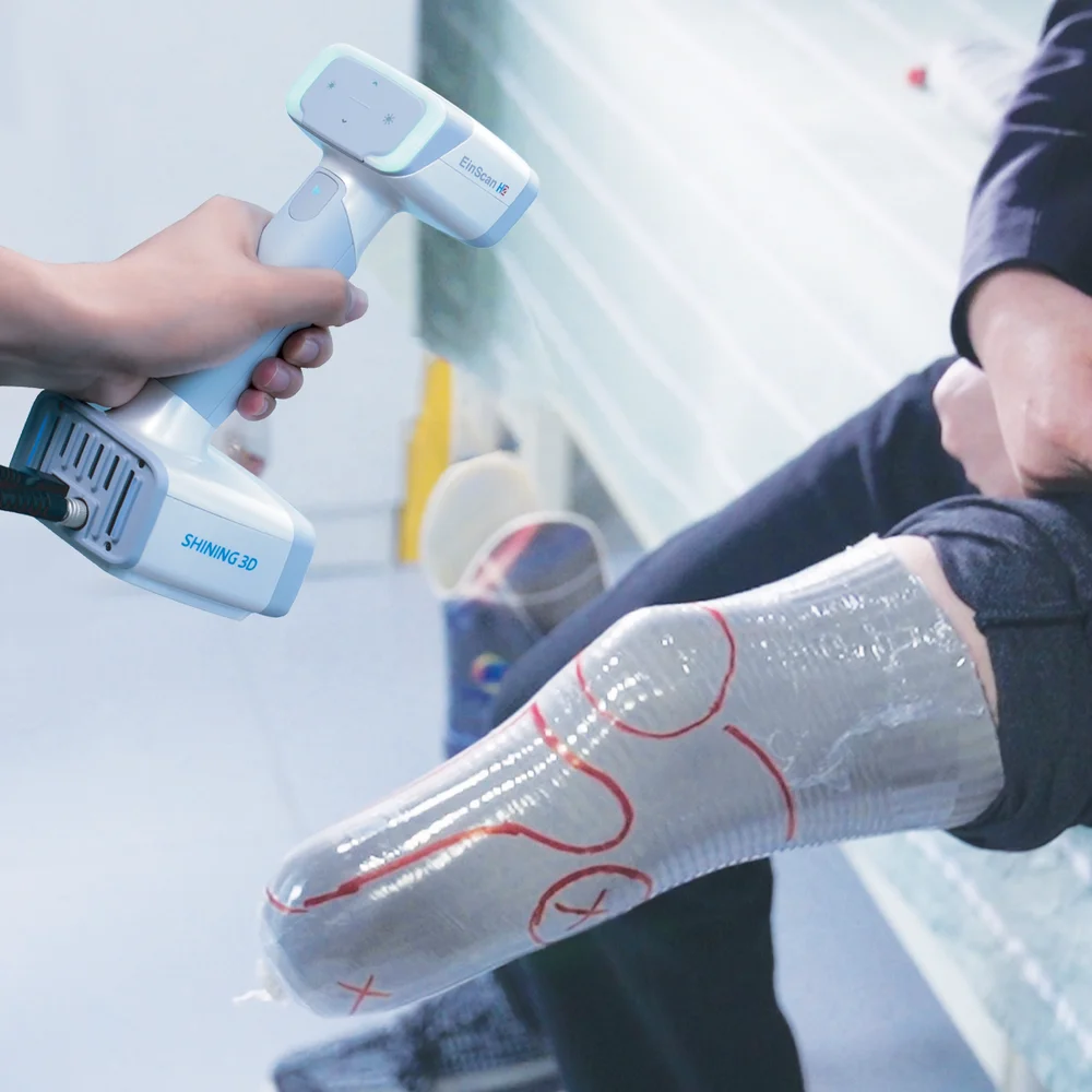 Digitalização de segmento corporal em um fluxo de órteses e próteses